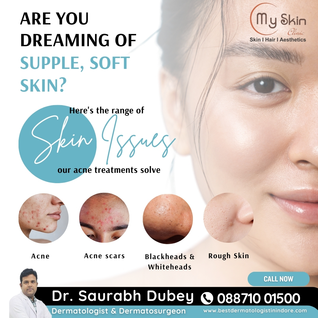 Best Skin Doctor in Indore